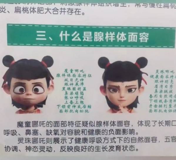 哪吒元素进入陕西医院腺样体面容科普海报