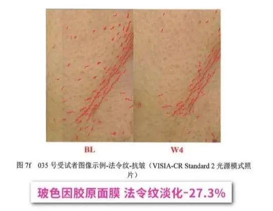 预算吃紧也能抗老，言之有物玻色因系列真香，平价抗老宝藏！言之有物玻色因产品大揭秘