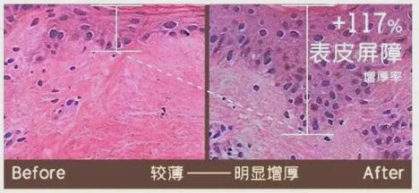预算吃紧也能抗老，言之有物玻色因系列真香，平价抗老宝藏！言之有物玻色因产品大揭秘