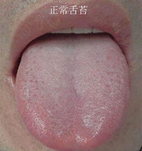 刷牙不刷舌头，竟成口臭等问题“元凶”，给舌头做“SPA”，每天10秒轻刮告别口腔烦恼