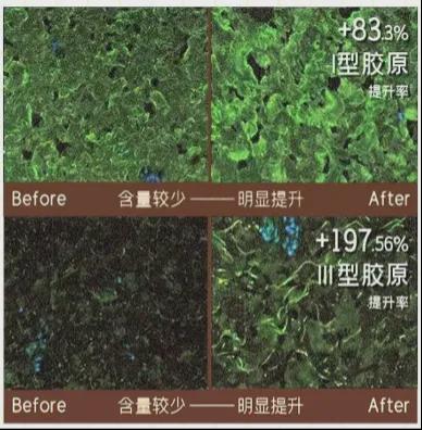 预算吃紧也能抗老，言之有物玻色因系列真香，平价抗老宝藏！言之有物玻色因产品大揭秘