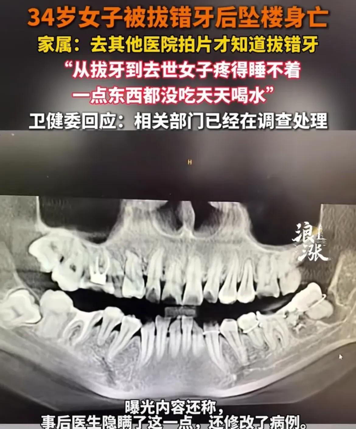 安庆一女子拔牙后绝望坠楼，医疗体系警钟敲响！，女子拔牙遇医疗事故，坠楼身亡谁之过？