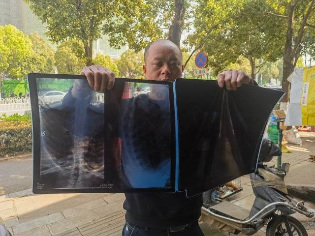 维修卷帘门摔伤索赔无果，解先生维权路在何方？ 脚手架上的意外：解先生索赔遭遇“闭门羹”