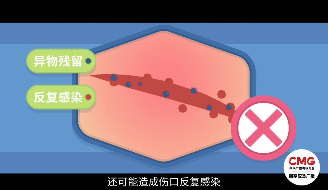 浴室玻璃门爆裂伤人频发，如何急救成关键！，警惕！浴室玻璃门“暗藏杀机”，这些急救知识要掌握