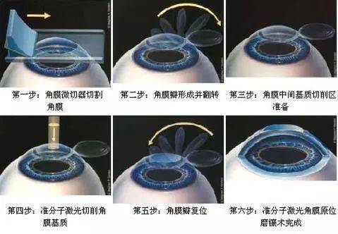 幼儿园及小学低龄段儿童近视防控：为孩子擦亮心灵之窗，从娃娃抓起：幼儿园和小学低年级近视防控全知道