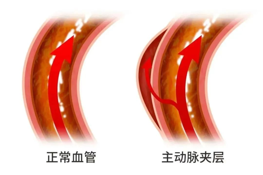 微创“补心”，张秀辉为患儿铺就健康未来
