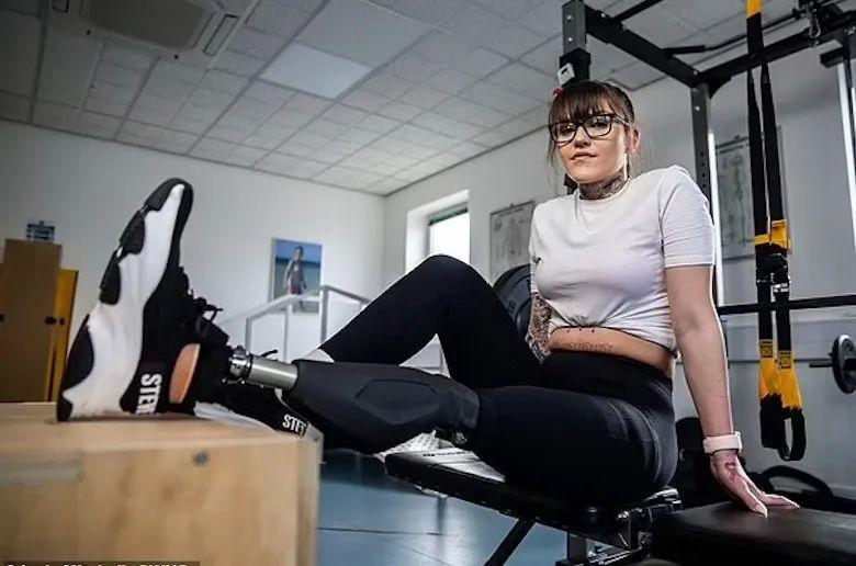 截肢后邂逅真爱，英国妹子的别样人生转折，截肢悲剧后，她竟收获了世间最美好的爱情